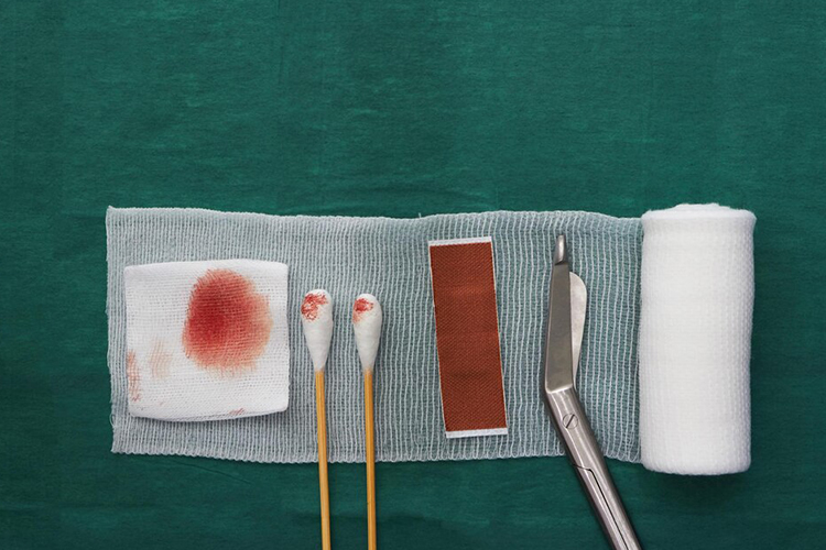 با گاز استریل یا پارچه تمیز، بهآرامی زخم و ناحیه اطراف آن را خشک کنید.